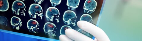 SNM News ¦ Introduction : Stratification du risque cardio-vasculaire et définition du type de prévention cardiovasculaire- N°107